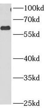 CCT3 Antibody