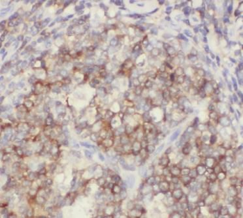 ITGAL Mouse Monoclonal Antibody