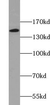 ITGAX Rabbit Polyclonal Antibody
