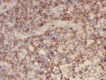 ITGAX Rabbit Polyclonal Antibody