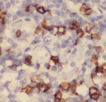 ITGAX Mouse Monoclonal Antibody