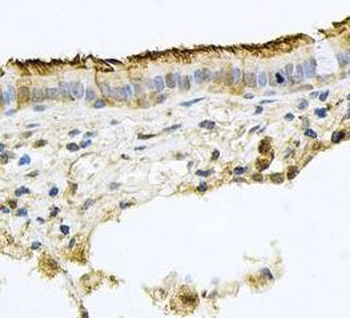 PROM1 Antibody