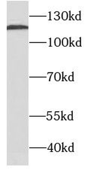 SDC1 Mouse Monoclonal Antibody