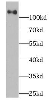 SDC1 Mouse Monoclonal Antibody