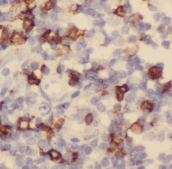 SDC1 Mouse Monoclonal Antibody