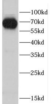 CD1A Rabbit Polyclonal Antibody