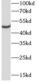 CD1A Mouse Monoclonal Antibody