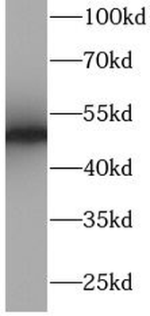 CD2 Rabbit Polyclonal Antibody