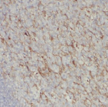 CD2 Rabbit Polyclonal Antibody