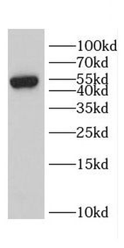 CD2 Rabbit Polyclonal Antibody