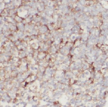 CD2 Rabbit Polyclonal Antibody