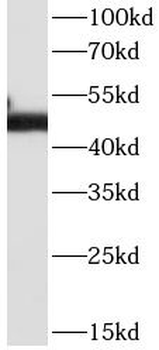 CD2 Mouse Monoclonal Antibody