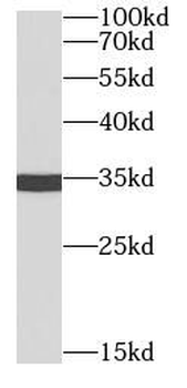 MS4A1 Mouse Monoclonal Antibody