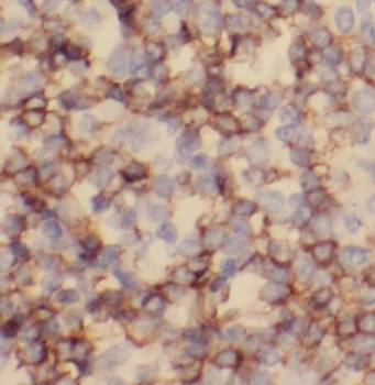 MS4A1 Mouse Monoclonal Antibody