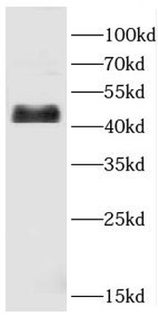 CD209 Rabbit Polyclonal Antibody