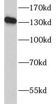 CD22 Mouse Monoclonal Antibody