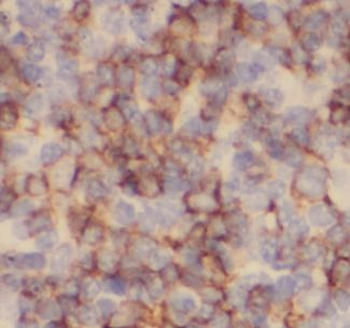 CD22 Mouse Monoclonal Antibody