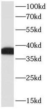 CD23 Mouse Monoclonal Antibody