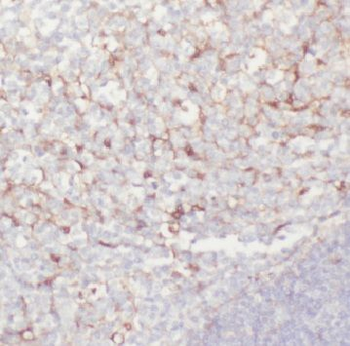 CD23 Mouse Monoclonal Antibody