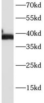 CD23 Mouse Monoclonal Antibody