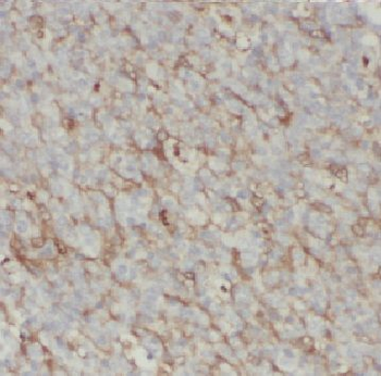 CD23 Mouse Monoclonal Antibody