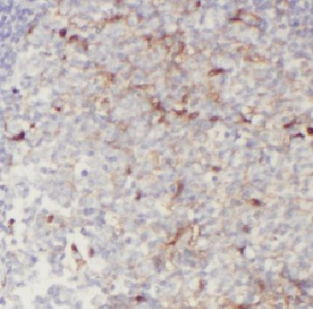 CD244 Rabbit Polyclonal Antibody