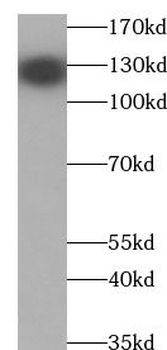 PECAM1 Rabbit Polyclonal Antibody