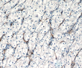 PECAM1 Rabbit Polyclonal Antibody