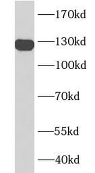 PECAM1 Mouse Monoclonal Antibody