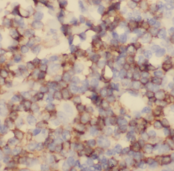 CD320 Antibody