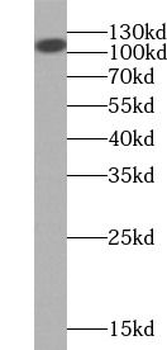 CD34 Rabbit Polyclonal Antibody