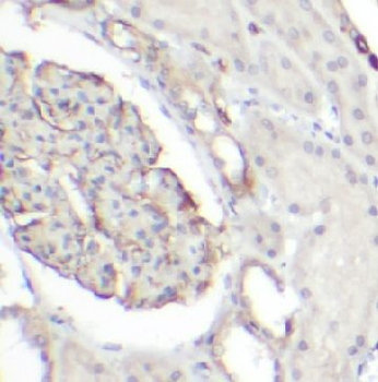 CD34 Rabbit Polyclonal Antibody