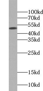 CD4 Rabbit Polyclonal Antibody