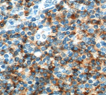 CD4 Rabbit Polyclonal Antibody