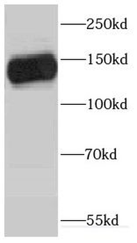 GP1BA Antibody