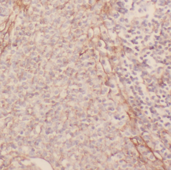 GP1BA Antibody