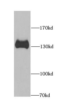 SPN Rabbit Polyclonal Antibody