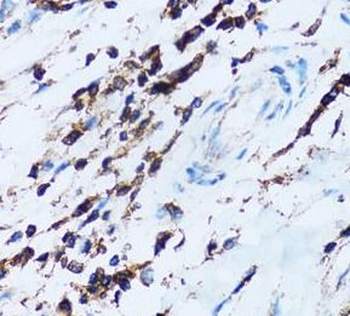SPN Rabbit Polyclonal Antibody