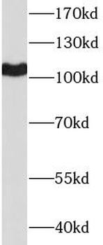 SPN Mouse Monoclonal Antibody