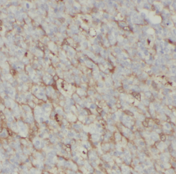 SPN Mouse Monoclonal Antibody