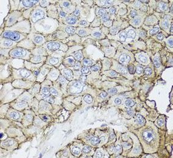 CD44 Rabbit Polyclonal Antibody