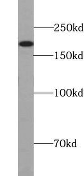 CD45 Rabbit Polyclonal Antibody