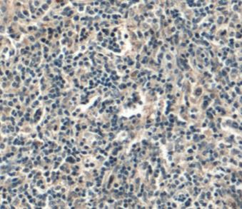 CD45 Rabbit Polyclonal Antibody