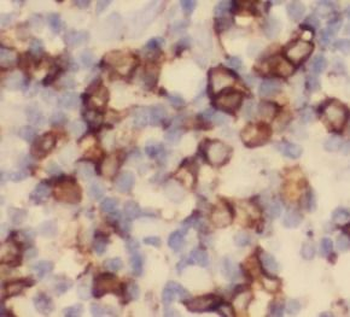 CD5 Antibody