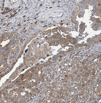 CD59 Antibody