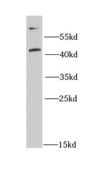CD63 Rabbit Polyclonal Antibody