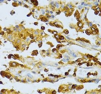 CD63 Rabbit Polyclonal Antibody