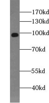 CD68 Rabbit Polyclonal Antibody
