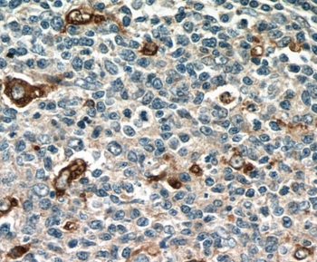 CD68 Rabbit Polyclonal Antibody