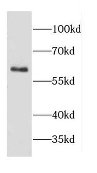 CD69 Rabbit Polyclonal Antibody
